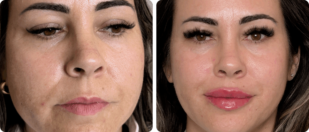 imgi_10_Frame-3-1024x437