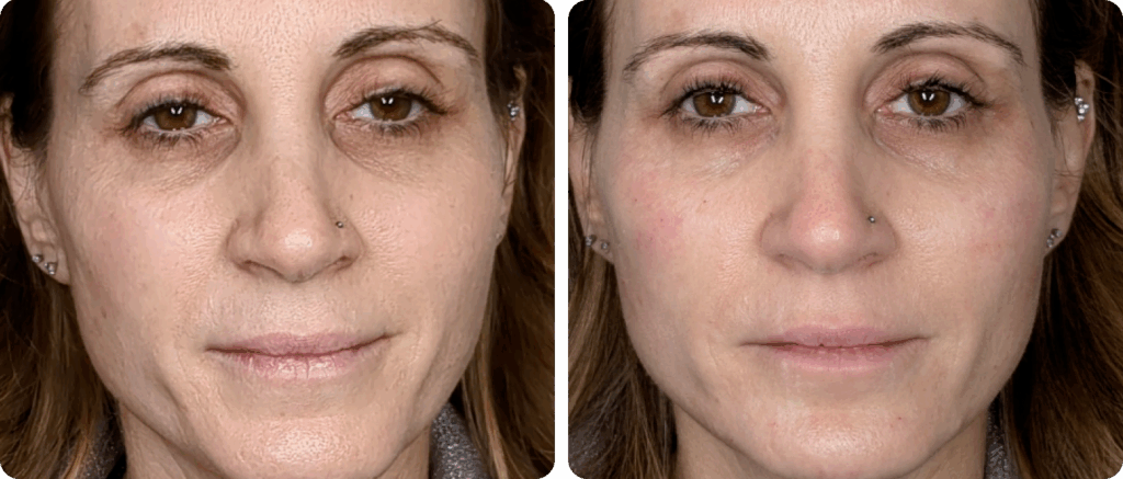 imgi_11_Frame-4-1024x437