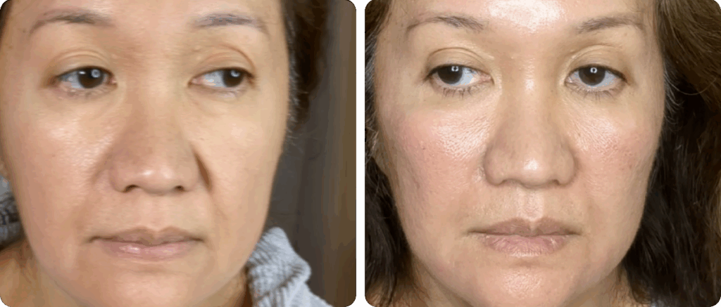 imgi_8_Frame-5-1-1024x437