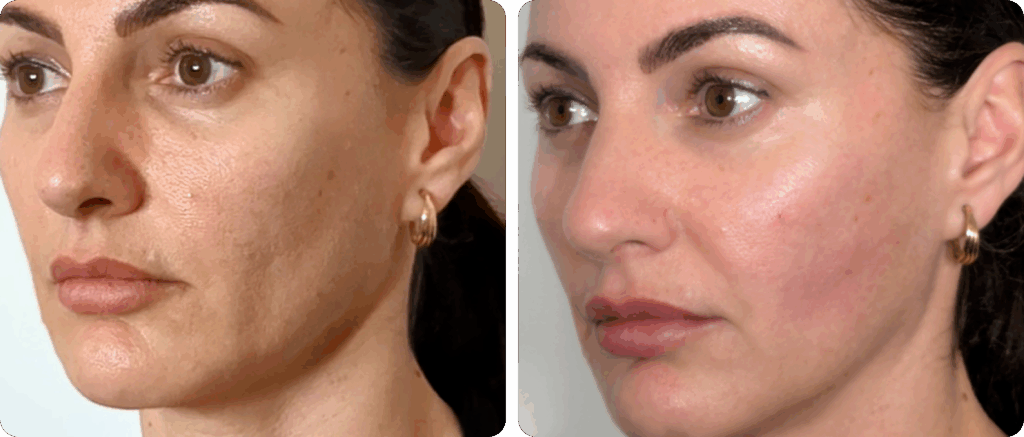 imgi_9_Frame-2-1024x437